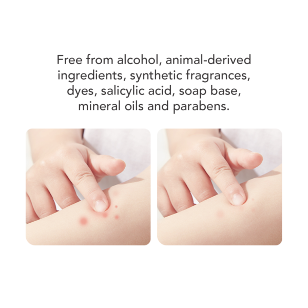 Sakumini Relief Balm Penyejuk Kulit Anti Gatal Iritasi Gigitan Nyamuk Pada Anak Bayi - Image 4